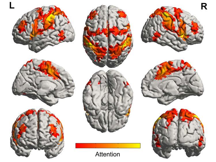 Music Activates Brain Regions